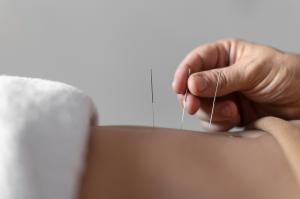 Press release image for Acupuncture Marketing Pros Launches Online Marketing Services for Acupuncture Clinics in the U.S. and Canada