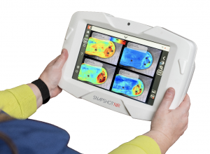 Press release image for MediMax Global Appointed Exclusive Distributor of Kent Imaging’s SnapshotNIR Point-of-Care Imaging Device in the UK/Eire